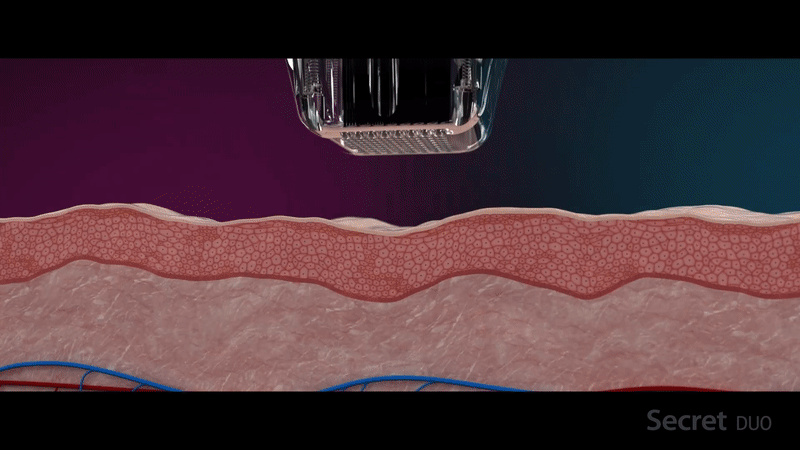 Emy Beauty Estetics - Kozmetika szegedi és budapesti szalonnal