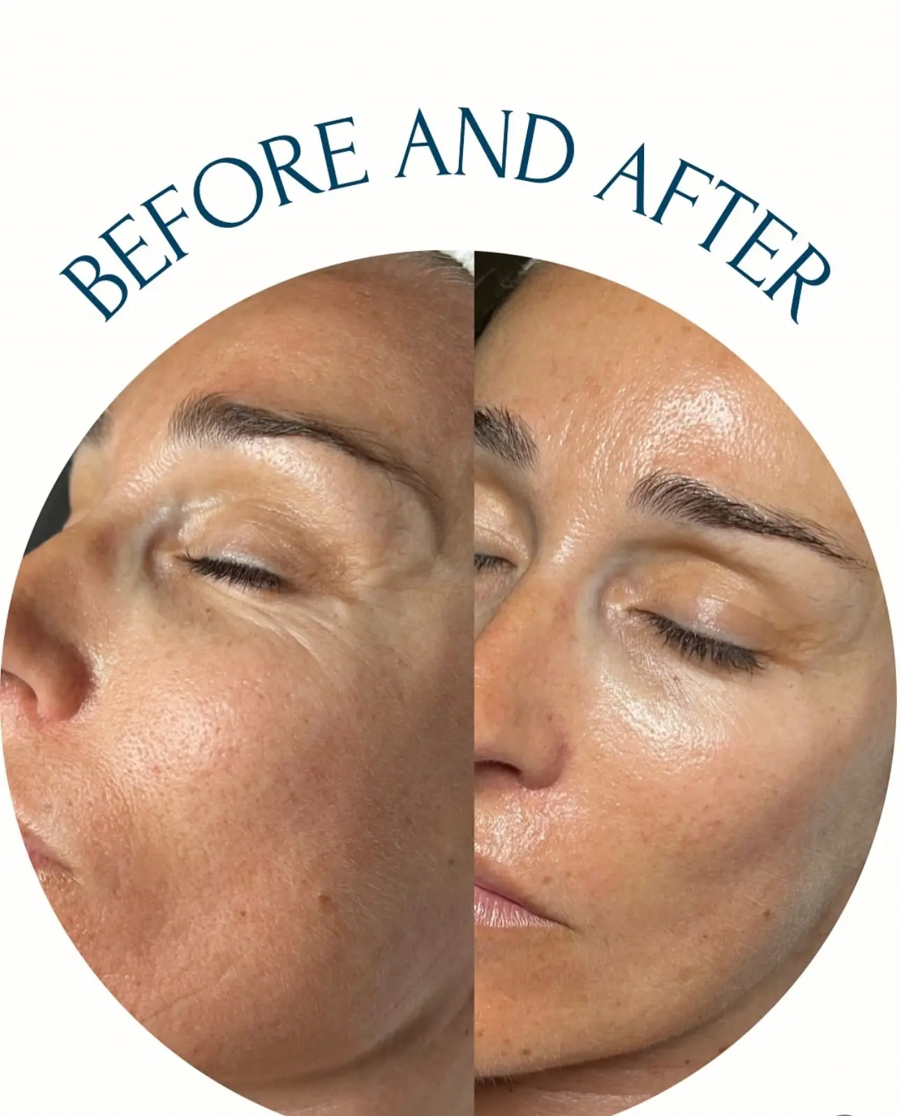 Emy Beauty Estetics - Kozmetika szegedi és budapesti szalonnal